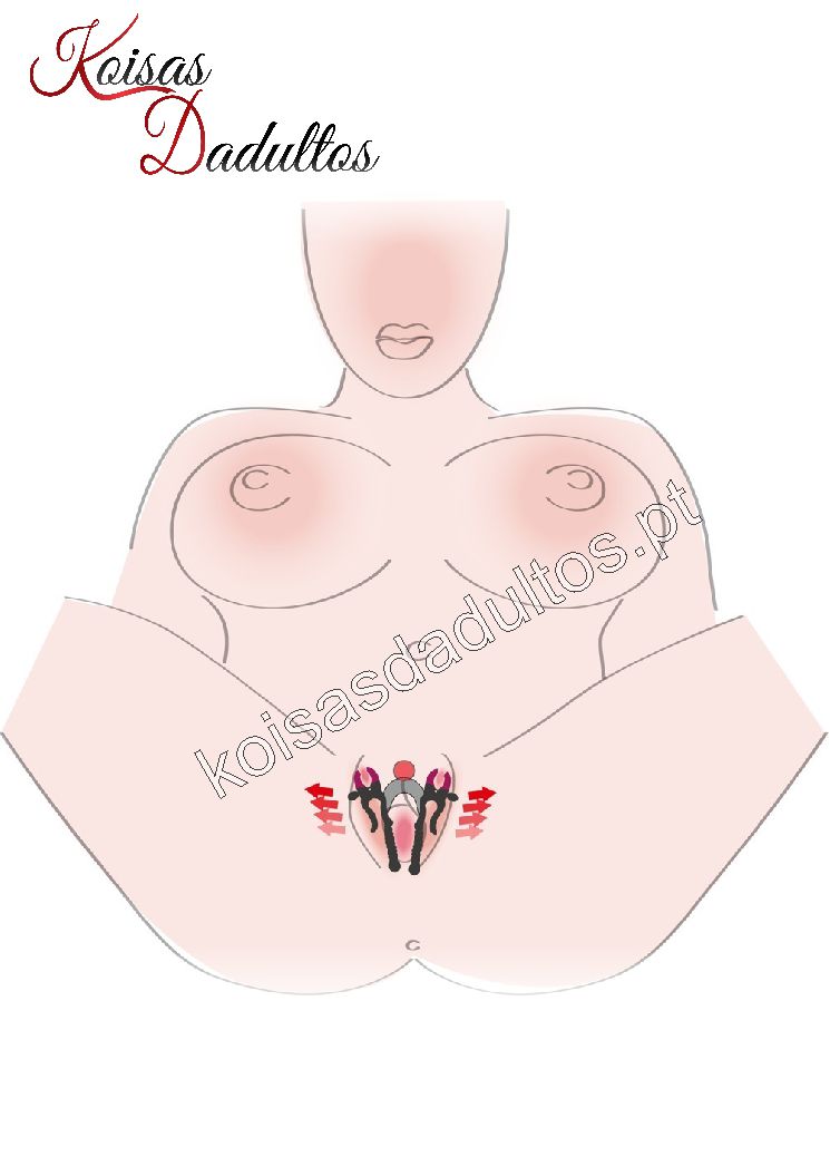 Separador de Lábios Vaginais Separador de Lábios Vaginais