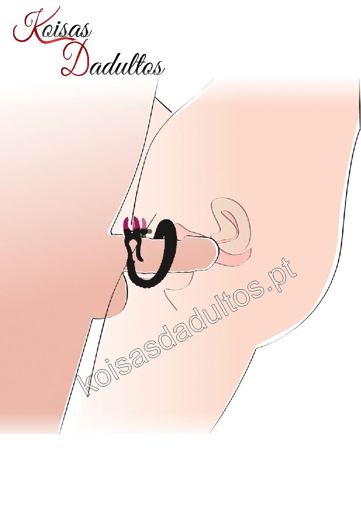 Separador de Lábios Vaginais Separador de Lábios Vaginais